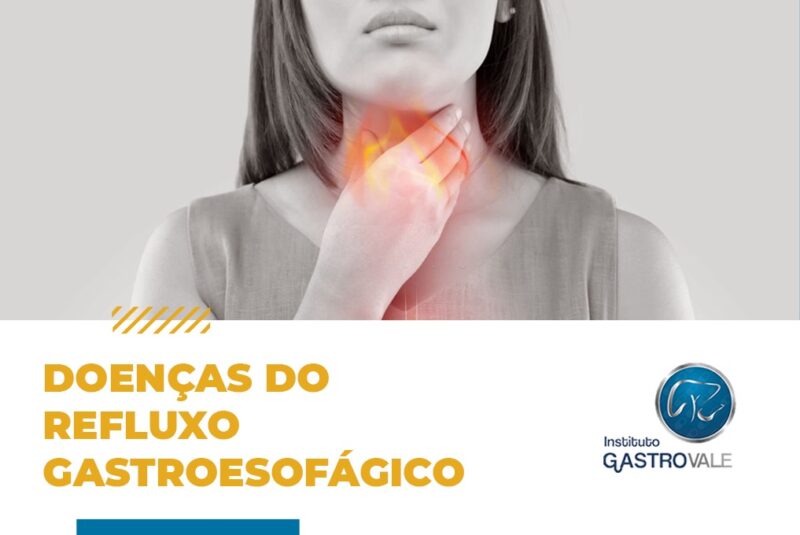 Refluxo o que é sintomas diagnóstico complicações e como tratar Gastrovale