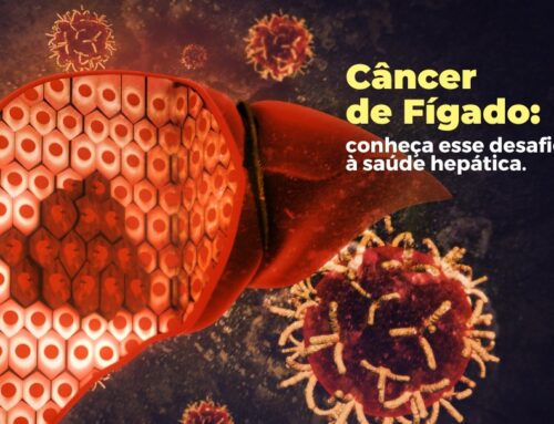 Câncer de Fígado: conheça esse desafio à saúde hepática