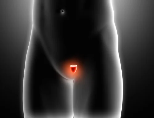 HÉRNIA FEMORAL